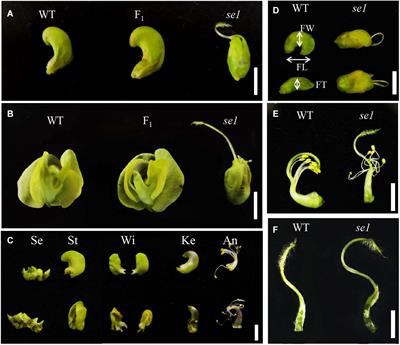 Mapping and Functional Characterization of Stigma Exposed 1, a DUF1005 Gene Controlling Petal and Stigma Cells in Mungbean (Vigna radiata)
